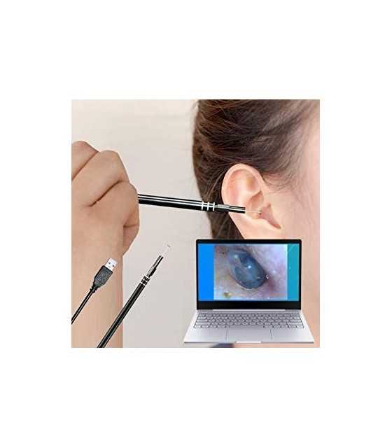 2-in-1 USB Ear Cleaning Endoscope HD Visual Ear Spoon Multifunctional Earpick