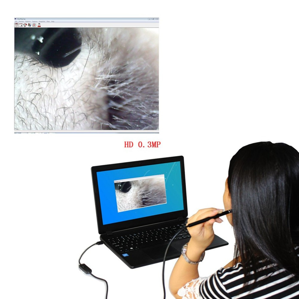 hd multifunction ear scope cleaner